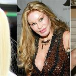 Celebrity Plastic Surgery