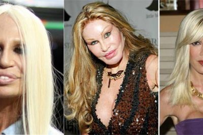 Celebrity Plastic Surgery