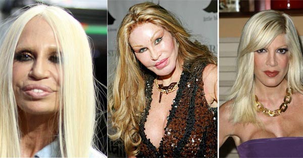 Celebrity Plastic Surgery