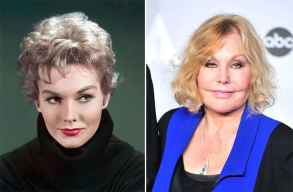 Kim Novak Plastic Surgery Bad Facial Work Plastic Surgery Talks Kim Novak Plastic Surgery Bad Facial Work Plastic Surgery Talks