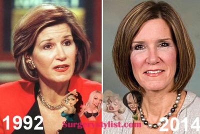 Mary Matalin Plastic Surgery - Facelift Done Well - Plastic Surgery Talks