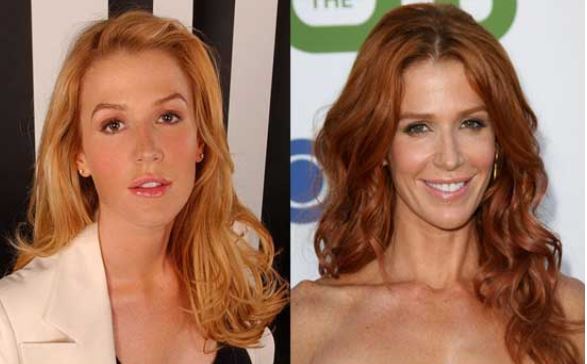 Poppy Montgomery Botox