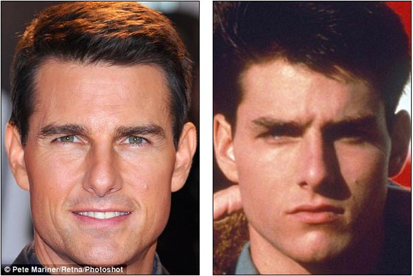 Tom Cruise Plastic Surgery