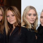 Ashley Olsen Plastic Surgery Before & After