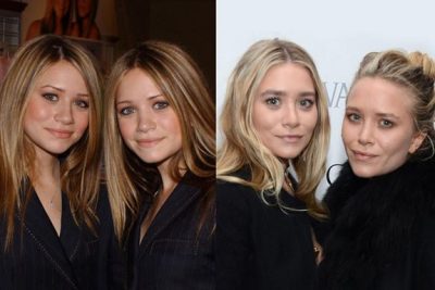 Ashley Olsen Plastic Surgery Before & After