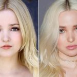 Dove Cameron Before and After Plastic Surgery