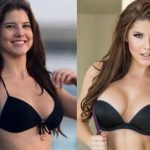 Amanda Cerny Before and After Plastic Surgery