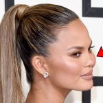 Chrissy Teigen Augmented Cheeks