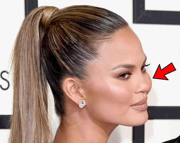 Chrissy Teigen Augmented Cheeks