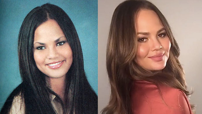 Chrissy Teigen Plastic Surgery Cheeks