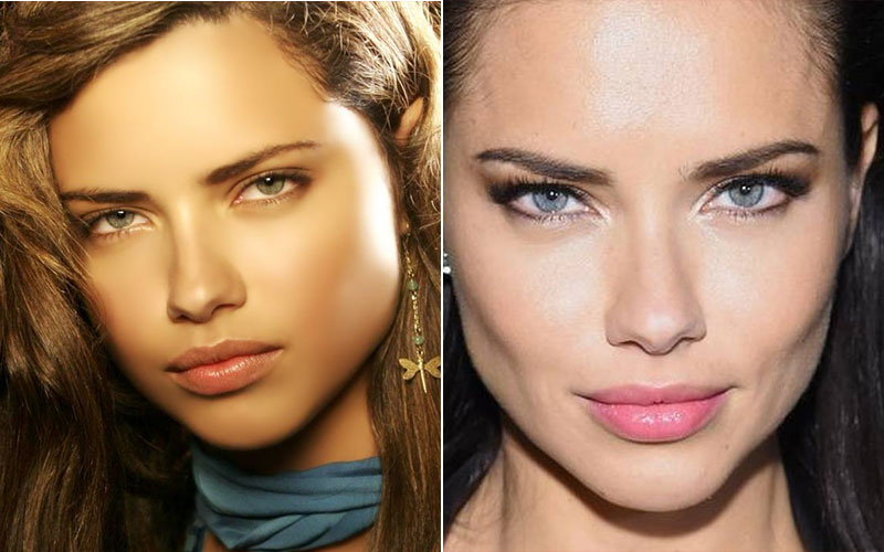 Adriana Lima chins plastic surgery before and after