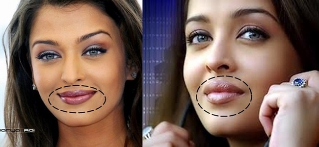 Aishwarya Rai lip collagen injections plastic surgery