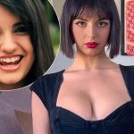 Rebecca Black Cosmetic Surgery