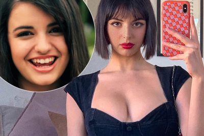 Rebecca Black Cosmetic Surgery