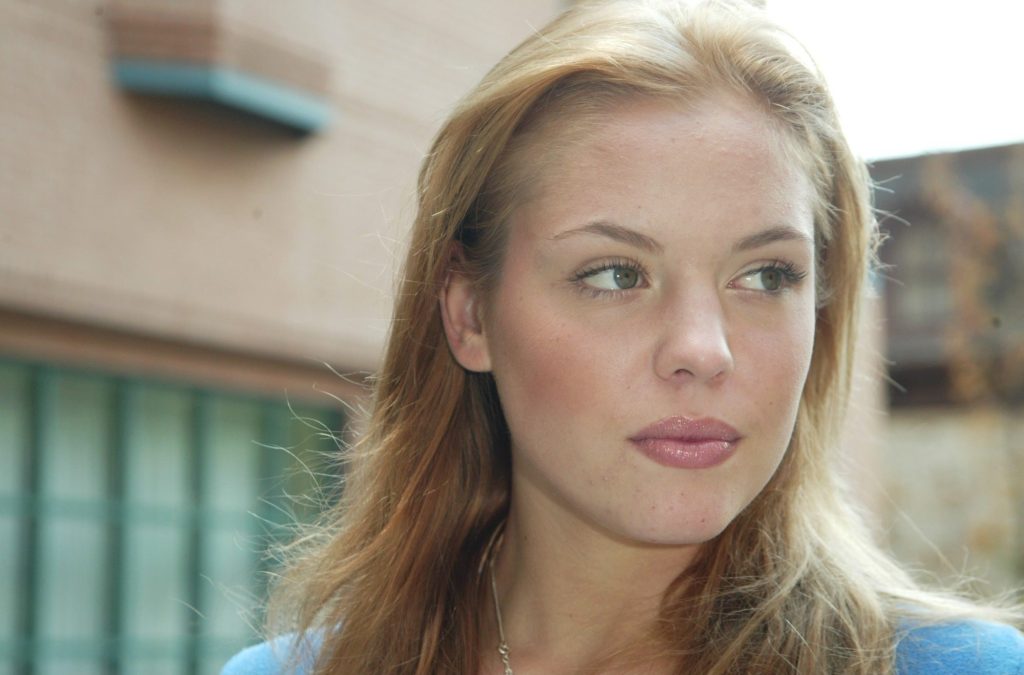 Agnes Bruckner Plastic Surgery Procedures