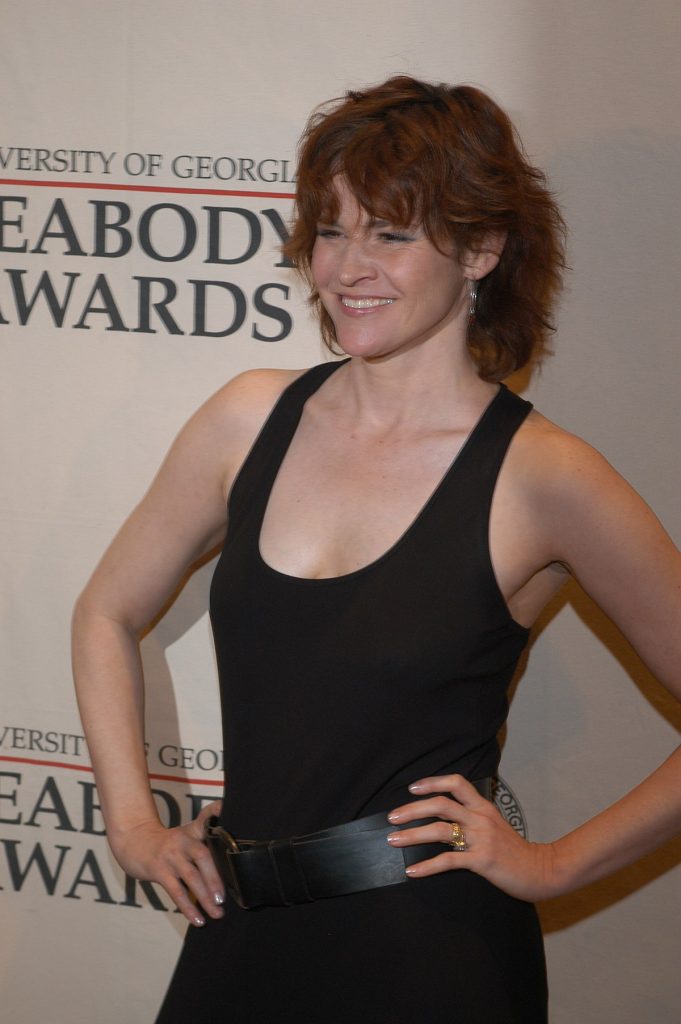 Ally Sheedy Plastic Surgery Body