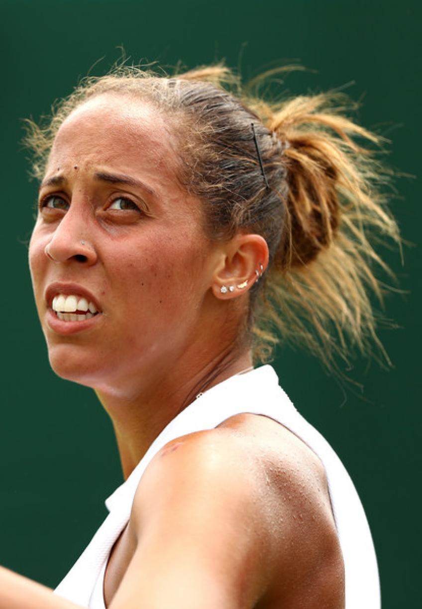 Did Madison Keys Have Plastic Surgery? Everything You Need To Know
