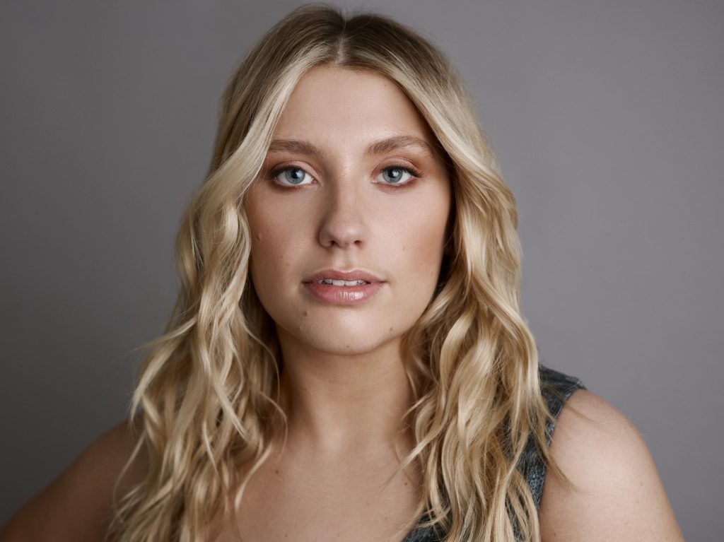 Ella Henderson Cosmetic Surgery Face