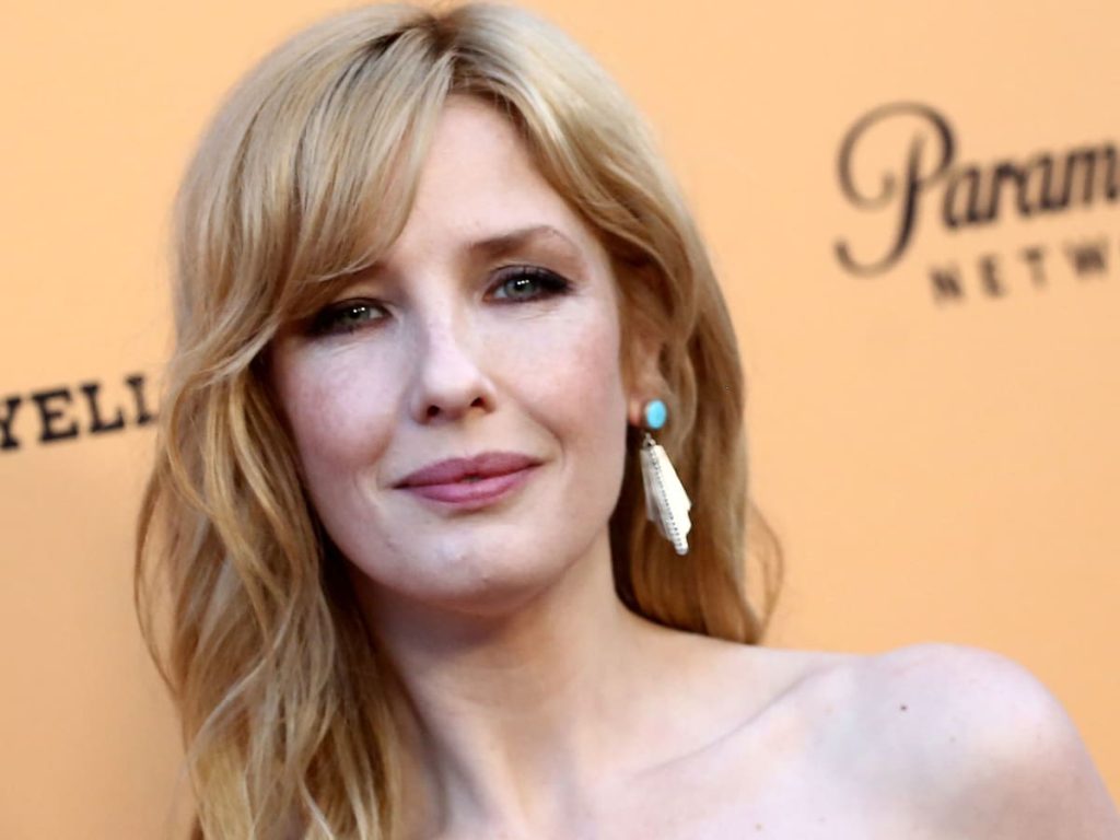 Kelly Reilly Plastic Surgery