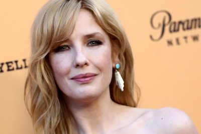 Kelly Reilly Plastic Surgery