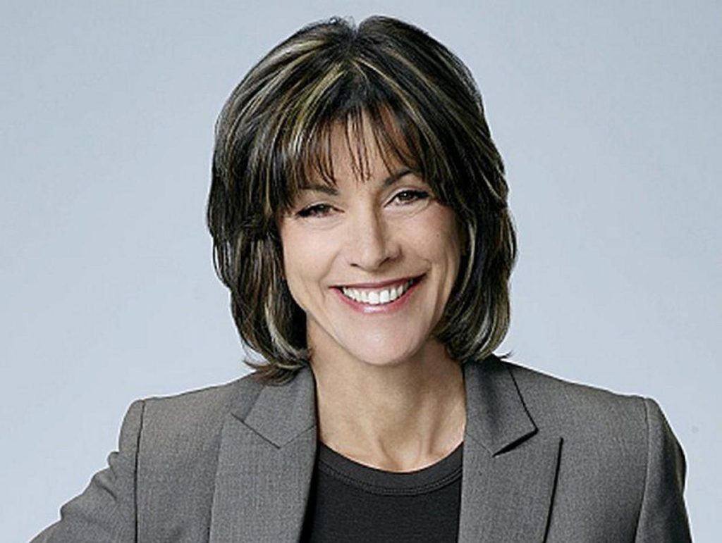 Wendie Malick Plastic Surgery Face