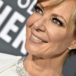 Allison Janney Cosmetic Surgery