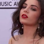 Charli XCX Plastic Surgery