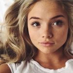 Natalie Alyn Lind Plastic Surgery