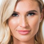 Billie Faiers Plastic Surgery Procedures