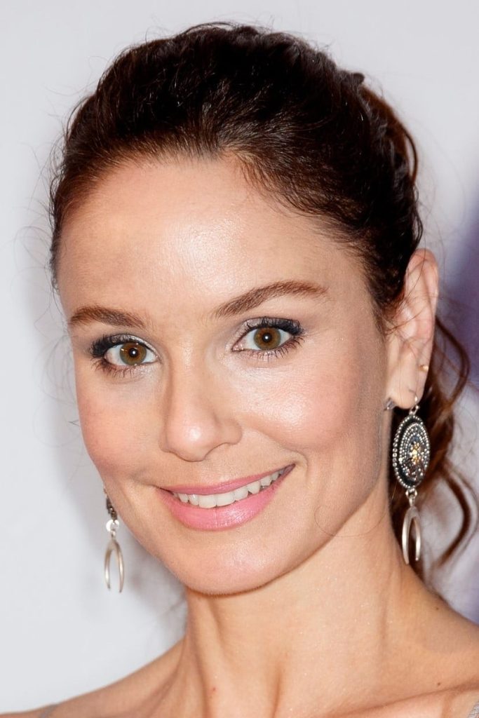 Sarah Wayne Callies Plastic Surgery Face