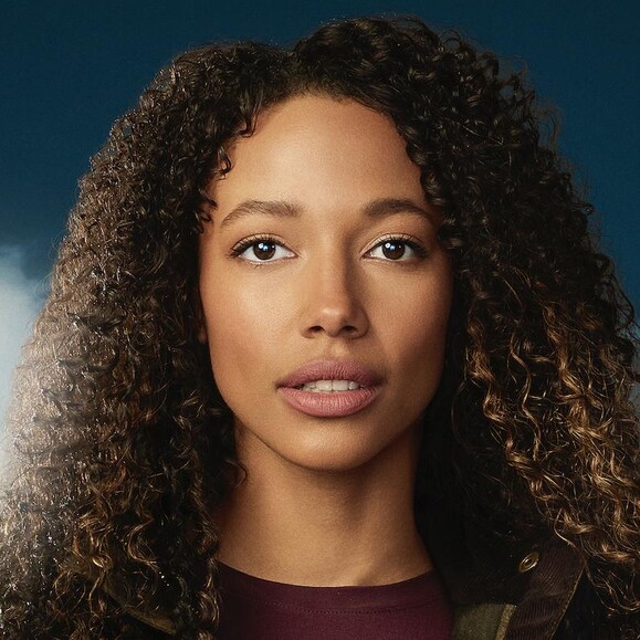 Kylie Bunbury Cosmetic Surgery Face