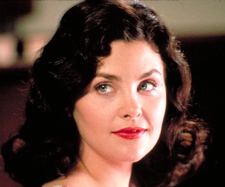 Sherilyn Fenn Plastic Surgery Face