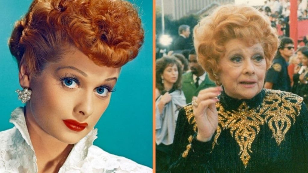 Lucille Ball Plastic Surgery Face