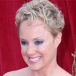 Sally Dynevor Plastic Surgery