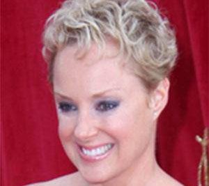 Sally Dynevor Plastic Surgery