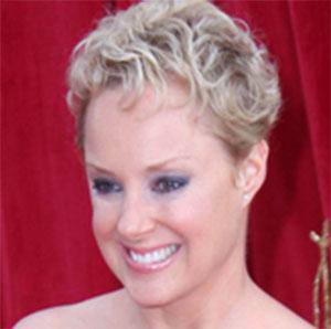 Sally Dynevor Plastic Surgery