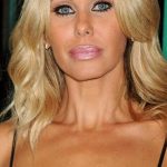 Shauna Sand Plastic Surgery