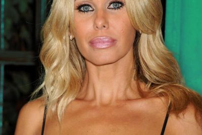 Shauna Sand Plastic Surgery