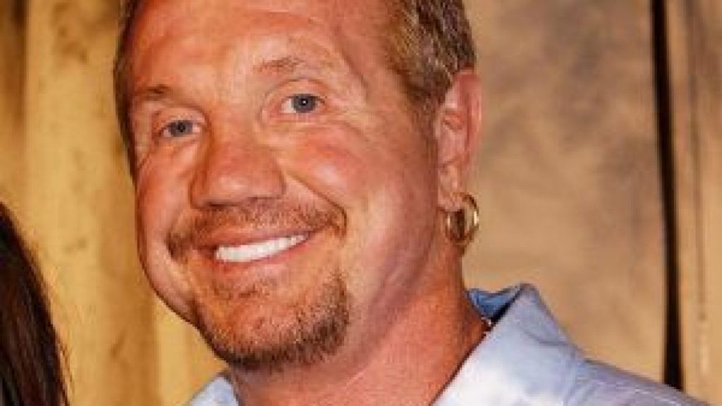 Diamond Dallas Page Cosmetic Surgery Face