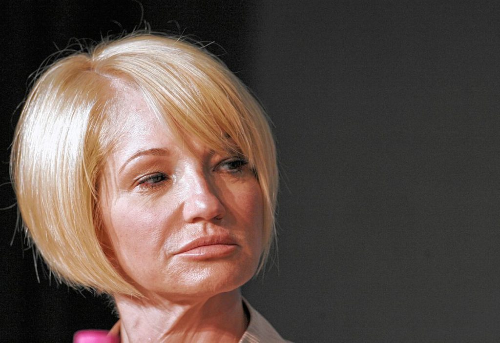 Ellen Barkin Plastic Surgery Face