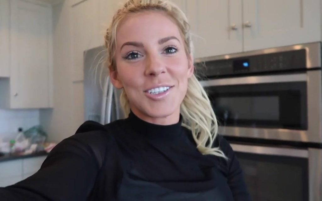 Heidi Somers Cosmetic Surgery Face