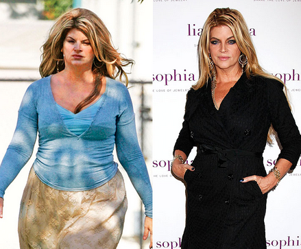 Kirstie Alley Cosmetic Surgery Body