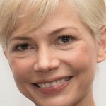 Michelle Williams Plastic Surgery