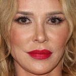 Brandi Glanville Botox, Fillers, and Nose Job