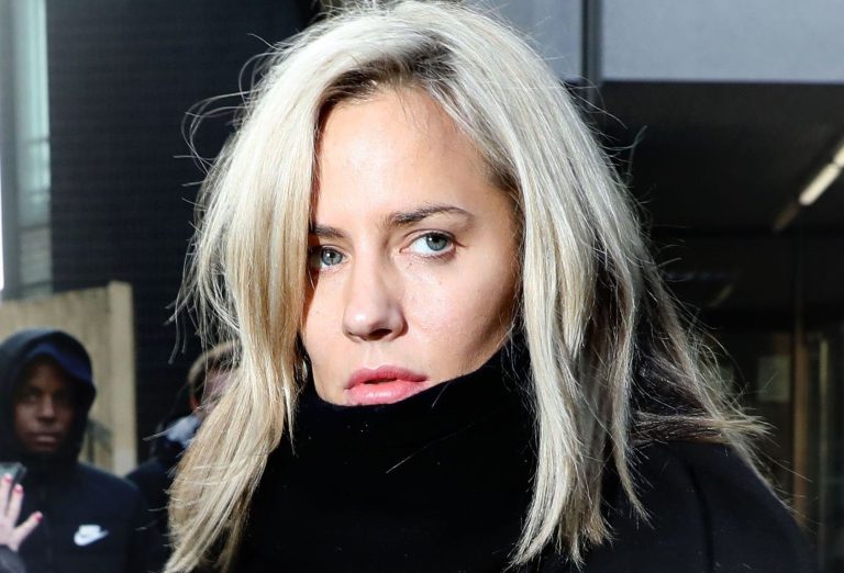 Caroline Flack Plastic Surgery