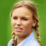 Caroline Wozniacki Plastic Surgery Procedures