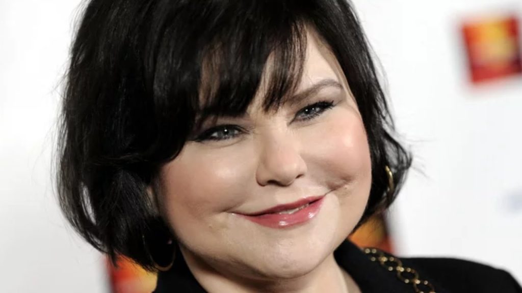 Delta Burke Plastic Surgery Face