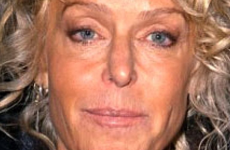 Farrah Fawcett Eyelid Surgery, Facelift, and Neck Lift