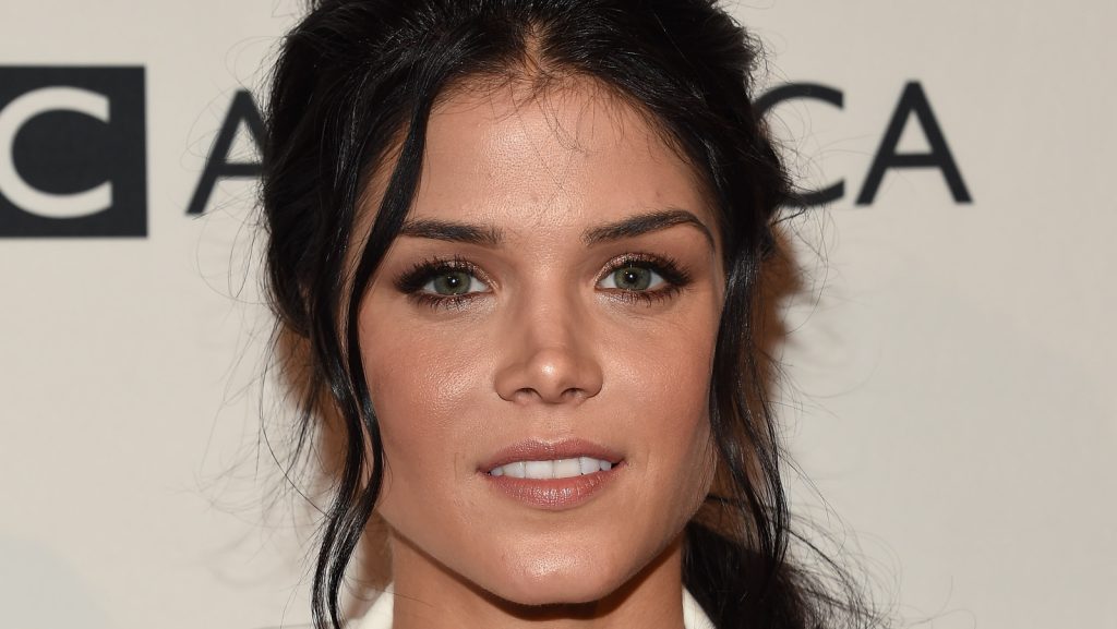 Marie Avgeropoulos Plastic Surgery