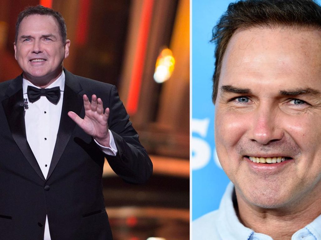 Norm Macdonald Plastic Surgery Face